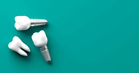 Where to start with dental implants