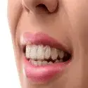 You’ll Love These Clear Braces!