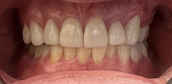 Post-treatment image showcasing improved patient appearance.