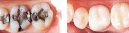 Before and After