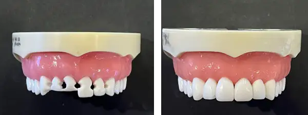 Bioclear models