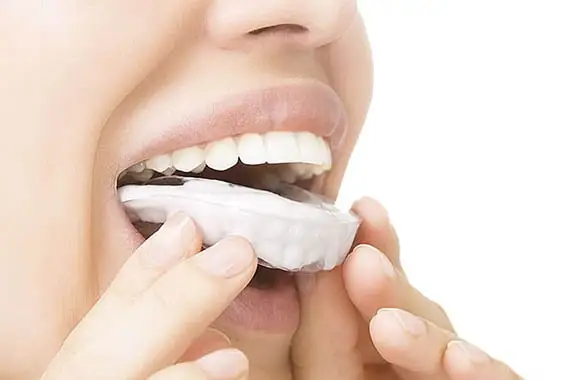Bite guard fitted over upper teeth