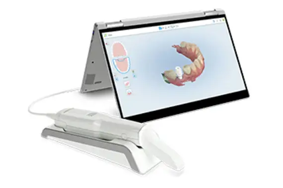 iTero Digital Impressions