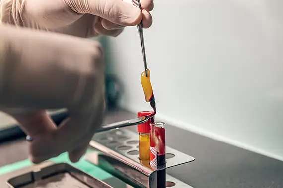 Platelet-Rich Fibrin PFR