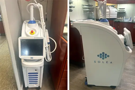 Solea Laser Treatment